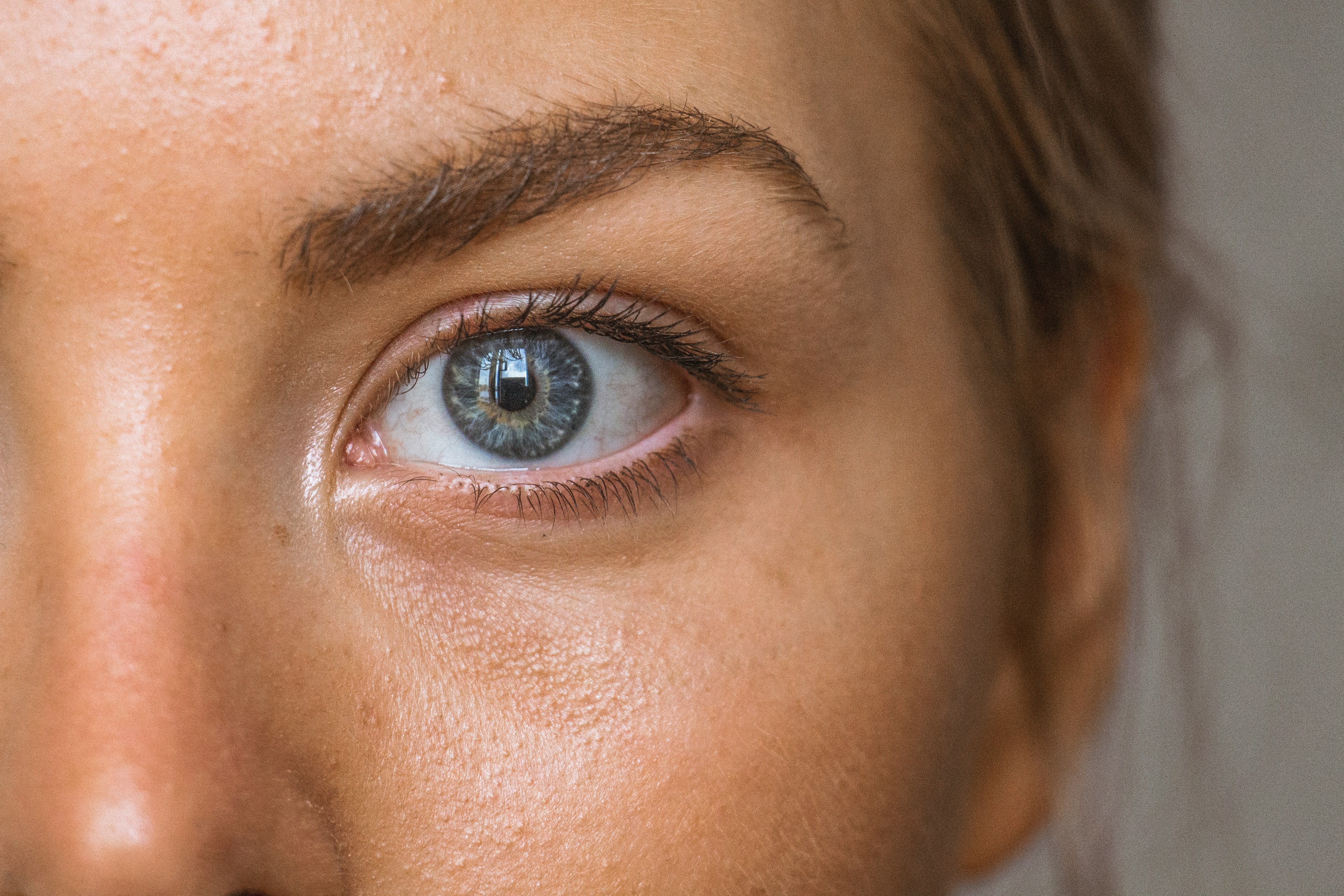 Dry Skin Under Eyes - Causes & Treatment Tips
