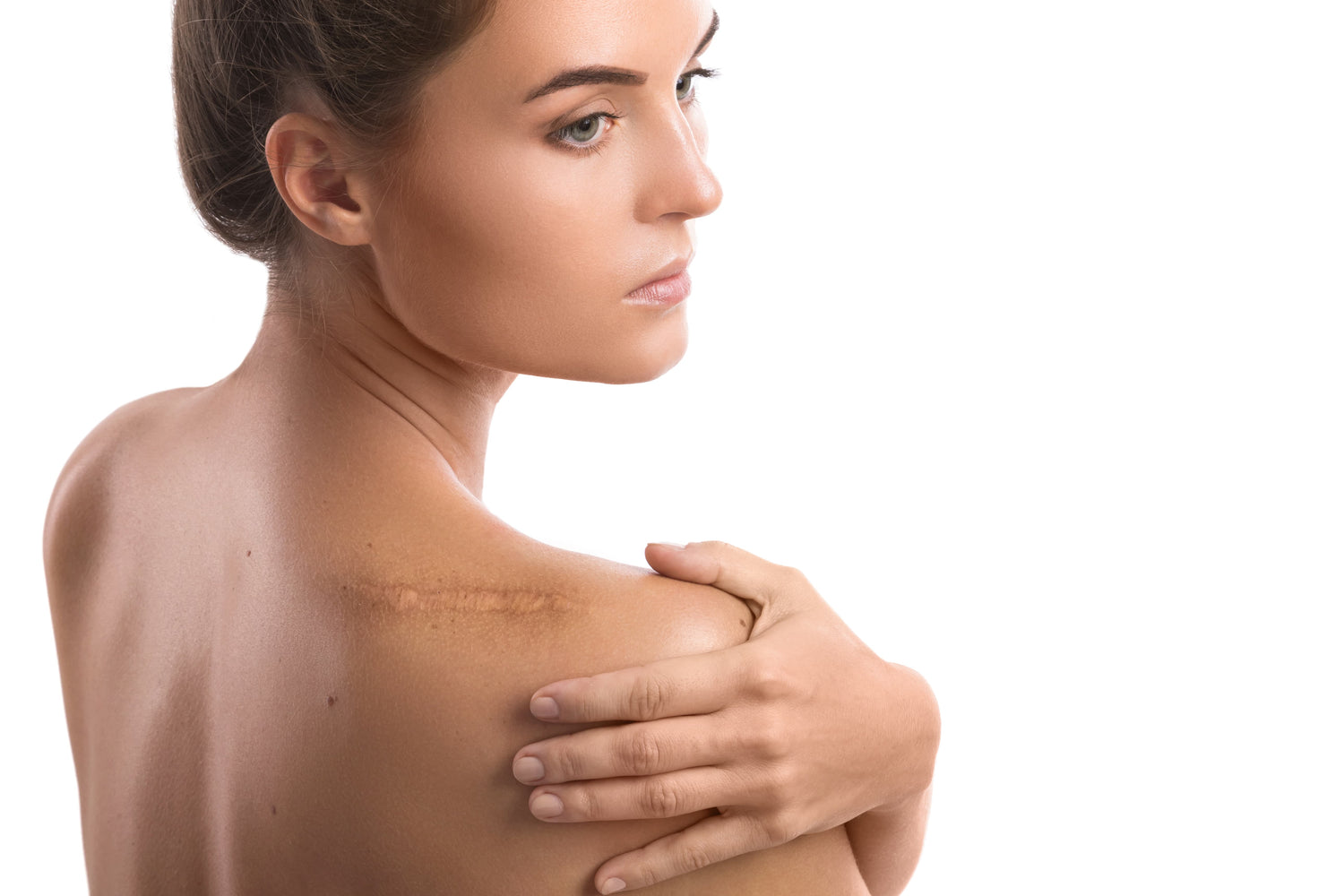 Natural Remedies to Remove Scars On Your Skin